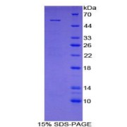 SDS-PAGE analysis of MBL2 Protein.