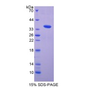 SDS-PAGE analysis of VEGFR1 Protein.