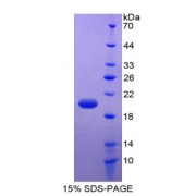 SDS-PAGE analysis of Leptin Protein.