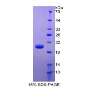 SDS-PAGE analysis of Leptin Protein.