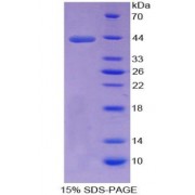 SDS-PAGE analysis of recombinant Rat Galanin Protein.