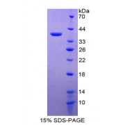 SDS-PAGE analysis of Metallothionein 2 Protein.