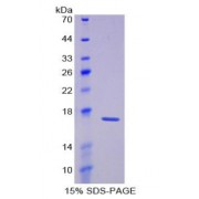 SDS-PAGE analysis of Laminin alpha 1 Protein.
