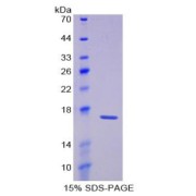 SDS-PAGE analysis of Laminin alpha 1 Protein.