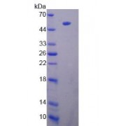 SDS-PAGE analysis of recombinant Rat Lipoprotein Lipase.