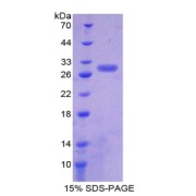 SDS-PAGE analysis of NAD-Dependent Protein Deacetylase Sirtuin-1 Protein.