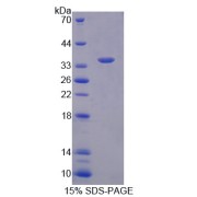 SDS-PAGE analysis of Neurochondrin Protein.