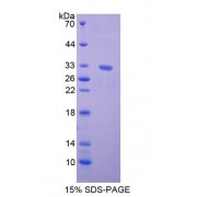 SDS-PAGE analysis of Kinesin Family, Member 5B Protein.