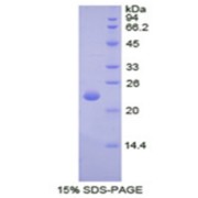SDS-PAGE analysis of Spectrin Alpha Chain, Non-Erythrocytic 1 Protein.