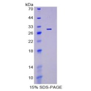 SDS-PAGE analysis of Podocalyxin Protein.