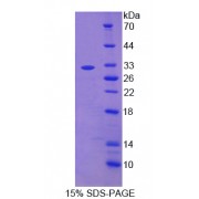 SDS-PAGE analysis of recombinant Rat Complement C2 Protein.