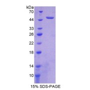 abx167626