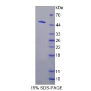 SDS-PAGE analysis of Hyaluronoglucosaminidase 1 Protein.