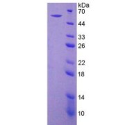 SDS-PAGE analysis of ENTPD1 Protein.