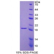 SDS-PAGE analysis of Laminin beta 2 Protein.