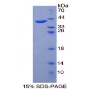 SDS-PAGE analysis of Keratin 20 Protein.