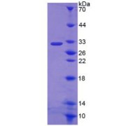 SDS-PAGE analysis of recombinant Rat NOX3 Protein.