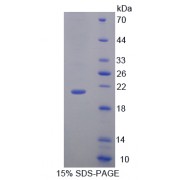 SDS-PAGE analysis of Amphiregulin Protein.