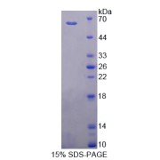 SDS-PAGE analysis of Cytochrome P450 11B1 Protein.