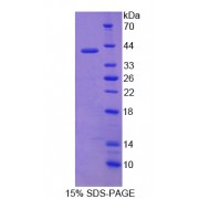 SDS-PAGE analysis of Aminolevulinate delta Dehydratase Protein.
