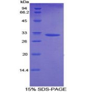 SDS-PAGE analysis of Diacylglycerol Kinase alpha Protein.
