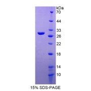 SDS-PAGE analysis of Myosin IF Protein.