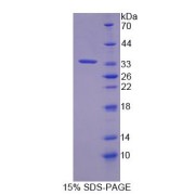 SDS-PAGE analysis of Melanoma Cell Adhesion Molecule Protein.