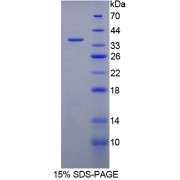 SDS-PAGE analysis of 11 beta Hydroxysteroid Dehydrogenase Type 1 Protein.