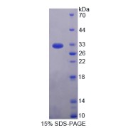 SDS-PAGE analysis of IL17RD Protein.