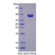 abx167721