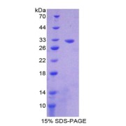SDS-PAGE analysis of Citrate Synthase Protein.