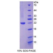 SDS-PAGE analysis of VEGI Protein.