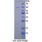 SDS-PAGE analysis of IL12B Protein.
