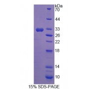 SDS-PAGE analysis of Nitric Oxide Synthase Trafficker Protein.