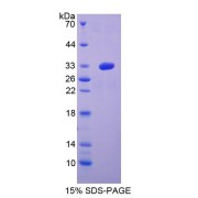 SDS-PAGE analysis of Meteorin Protein.