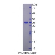 SDS-PAGE analysis of Nephroblastoma Overexpressed Gene Protein.