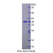 SDS-PAGE analysis of CCN Family Member 3 Protein.