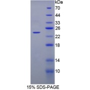 SDS-PAGE analysis of FGF1 Protein.