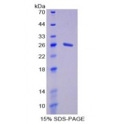 SDS-PAGE analysis of Membrane Protein, Palmitoylated 6 Protein.