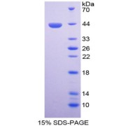 SDS-PAGE analysis of Matrix Gla Protein.