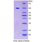 SDS-PAGE analysis of Matrix Gla Protein.