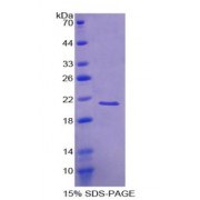 SDS-PAGE analysis of Visinin Like Protein 1 Protein.