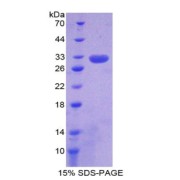 SDS-PAGE analysis of recombinant Human Brain Finger Protein.