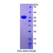 SDS-PAGE analysis of Renin Binding Protein.