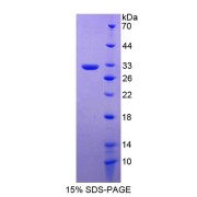 SDS-PAGE analysis of Regulator Of G Protein Signaling 19 Protein.