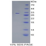 SDS-PAGE analysis of Mitogen Activated Protein Kinase 7 Protein.