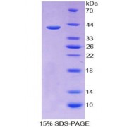 SDS-PAGE analysis of C-C Motif Chemokine Ligand 13 Protein.