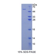 SDS-PAGE analysis of Programmed Cell Death Protein 6 Interacting Protein.