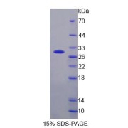 SDS-PAGE analysis of recombinant Human Notch2 N-Terminal Like Protein.