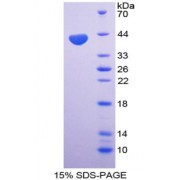 SDS-PAGE analysis of MIP1b Protein.